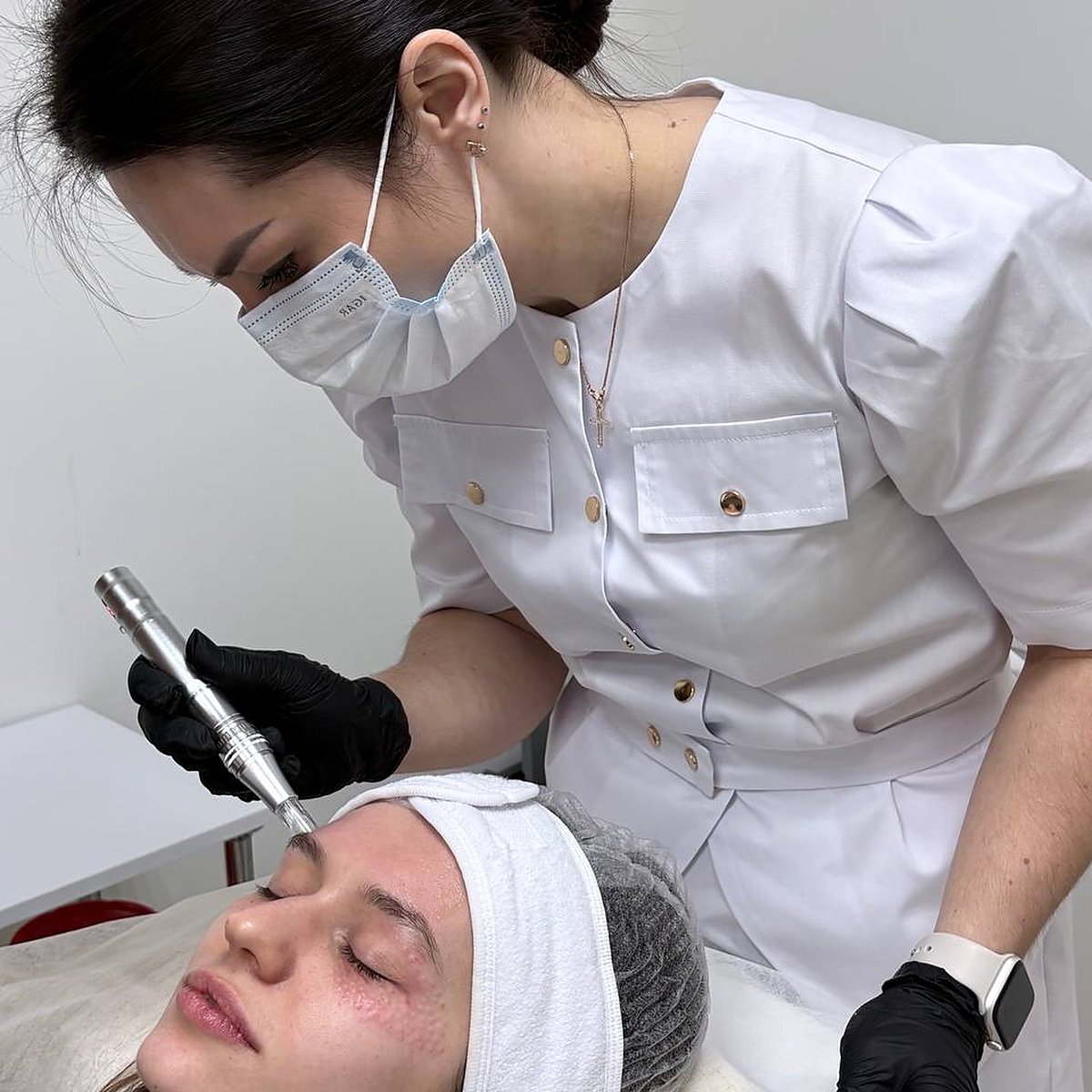 Мікронідлінг Dermapen